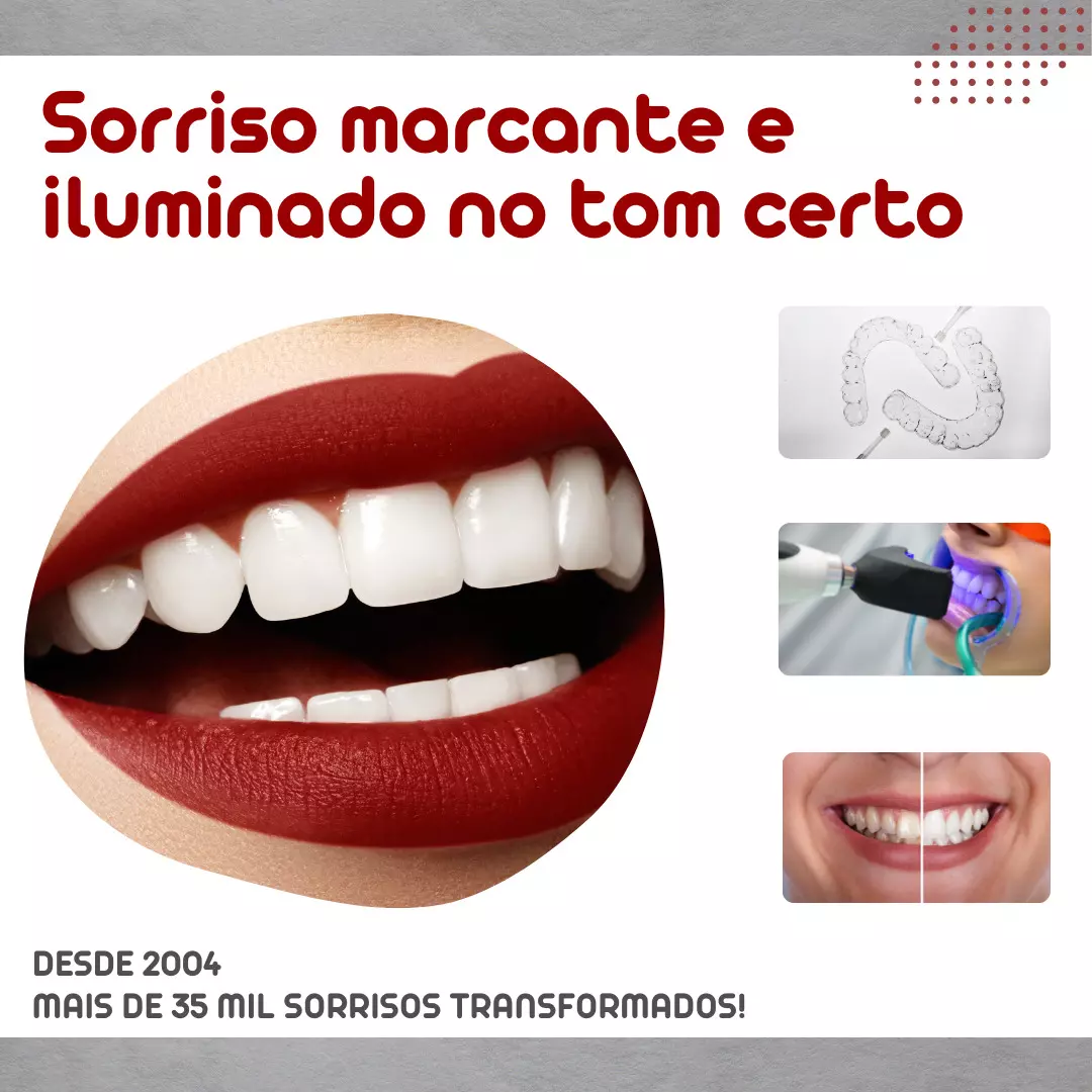 CLAREAMENTO DENTAL